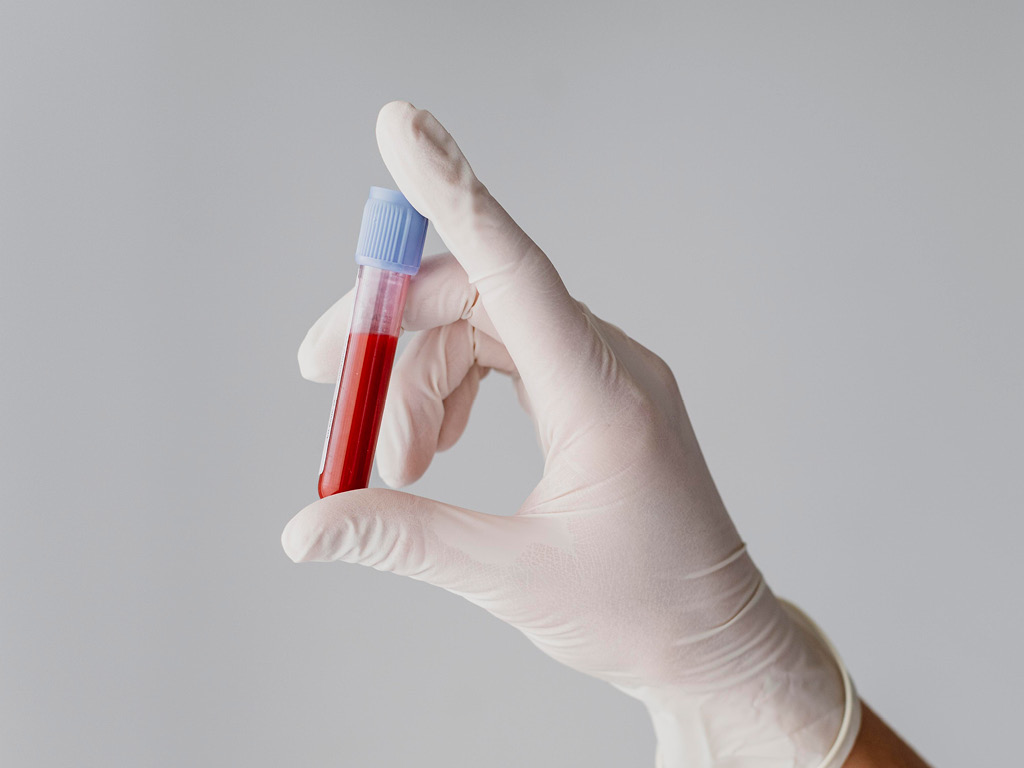 probirka-s-analizom-krovi-1 Общий анализ крови