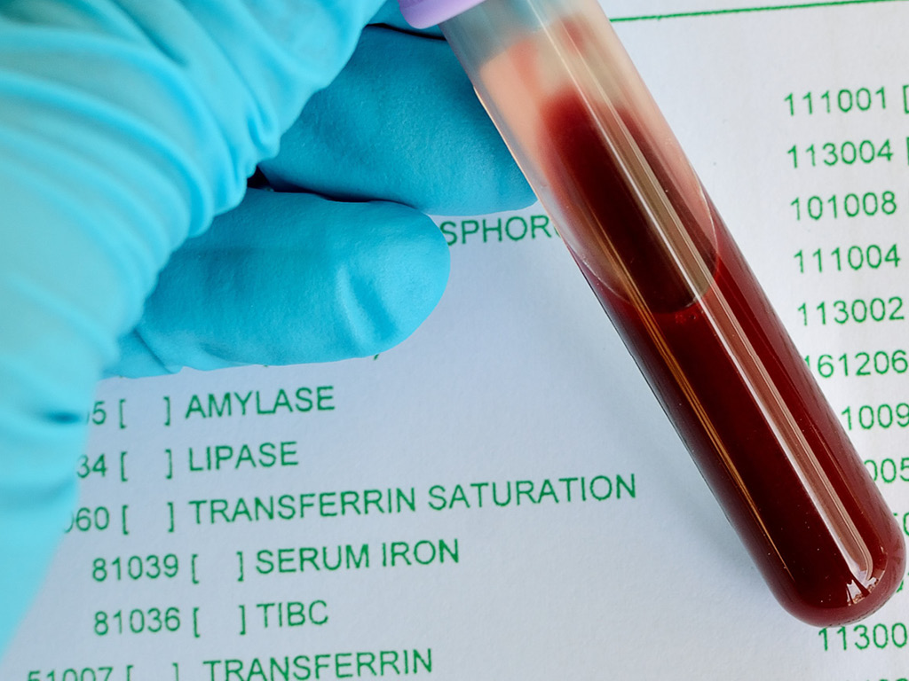 probirka-s-analizom-krovi Биохимический анализ крови